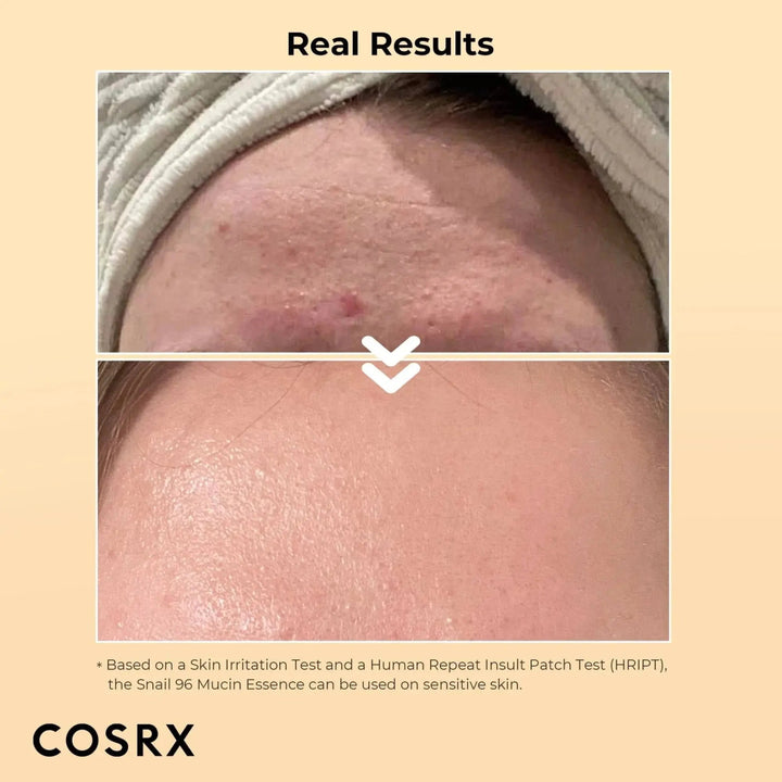 [Bundle Offer - CORSX Snail Mucin Skin Repair Glow Kit] Advanced Snail 96 Mucin Power Essence - Facial Essence 100ml + Advanced Snail 92 All in one Cream COSRX - Luxeery