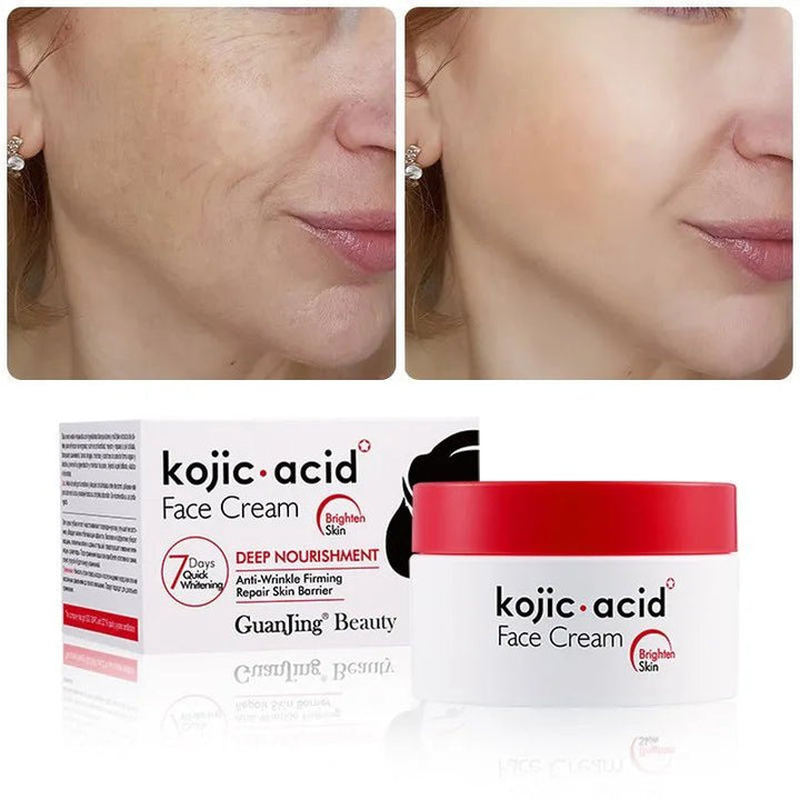 Guanjing Beauty Kojic Acid Face Cream 50G Guanjing - Luxeery