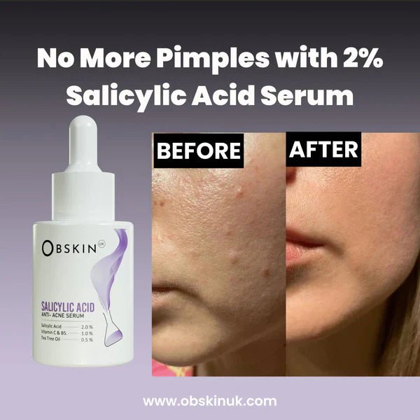 Obskin - Salicylic Acid 2% Serum Obskin - Luxeery