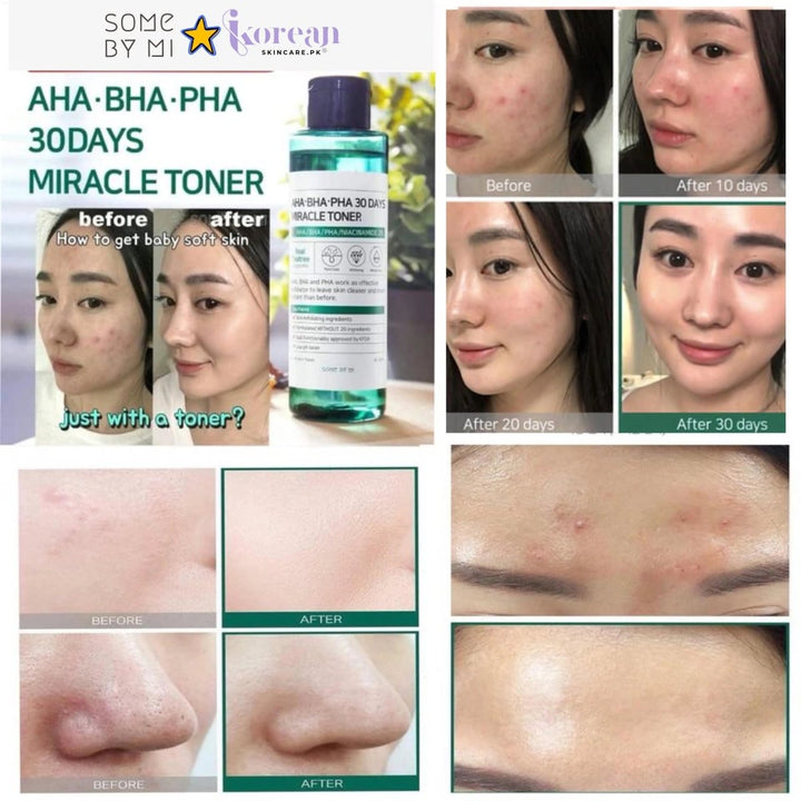 [SOMEBYMI] AHA - AHA.BHA.PHA 30 Days Miracle Toner 150ml - Korean - Skincare.pk SOME BY MI - Luxeery